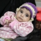Unicef 2020 February Malnutrition 0017
