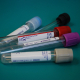 laboratory-medical-lab-stockpack-pixabay.jpg laboratory, medical, lab
