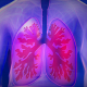 upper-body-lung-copd-stockpack-pixabay.jpg upper body, lung, copd