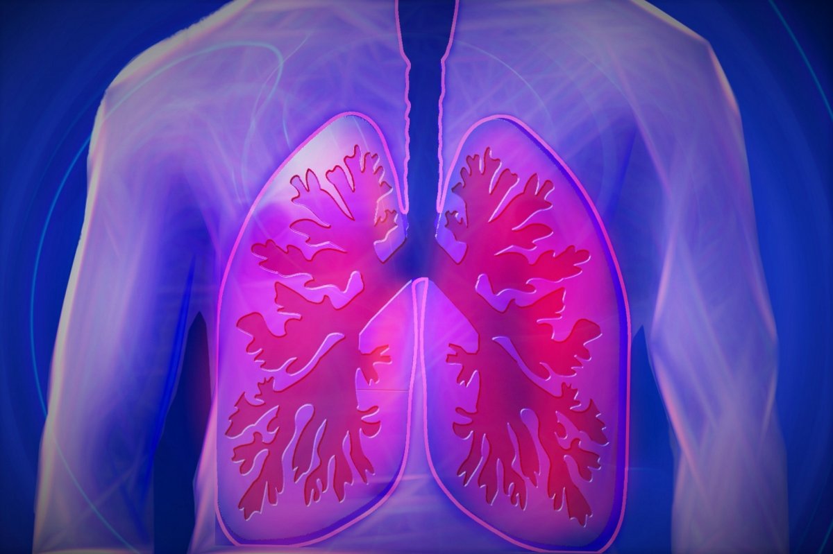 upper-body-lung-copd-stockpack-pixabay.jpg upper body, lung, copd