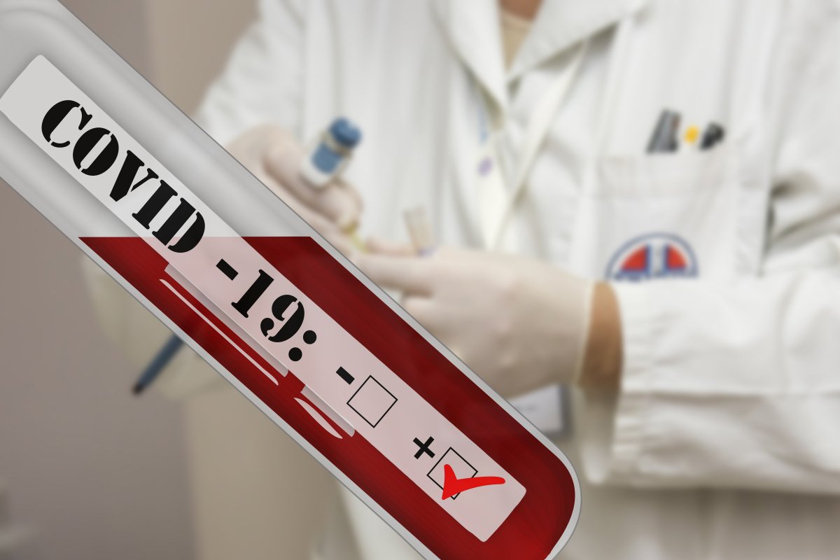 coronavirus-covid-19-positive-test-tube-stockpack-pixabay.jpg coronavirus, covid-19 positive, test tube