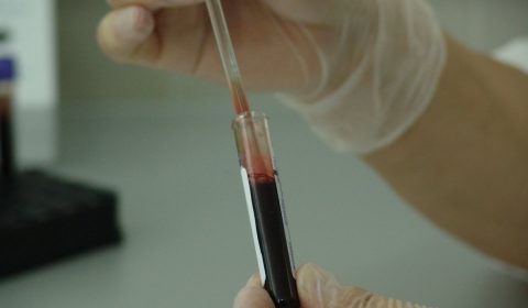 blood, vial, analysis