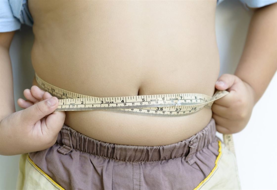 918 Overweight Child Obese