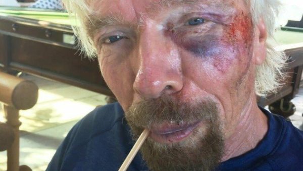 Richard Branson Accident Bicicleta