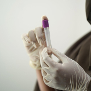 blood-test-blood-sample-medical-technology-stockpack-pixabay.jpg blood test, blood sample, medical technology