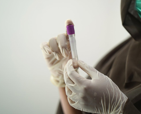 blood-test-blood-sample-medical-technology-stockpack-pixabay.jpg blood test, blood sample, medical technology