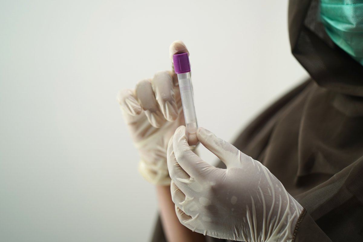 blood-test-blood-sample-medical-technology-stockpack-pixabay.jpg blood test, blood sample, medical technology