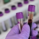 laboratory-medical-medicine-stockpack-pixabay.jpg laboratory, medical, medicine