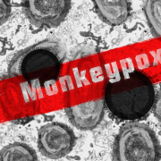 monkey-pox-monkeypox-virus-virus-stockpack-pixabay.jpg monkey pox, monkeypox virus, virus