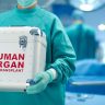 Transplant Multiorgan