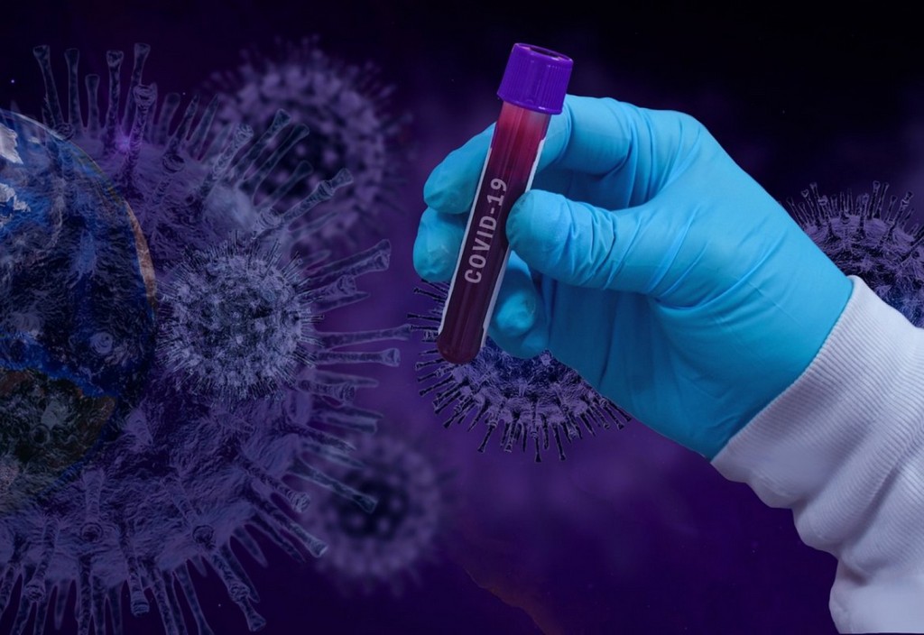 covid-19-coronavirus-epidemic-stockpack-pixabay.jpg covid-19, coronavirus, epidemic