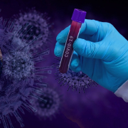 covid-19, coronavirus, epidemic
