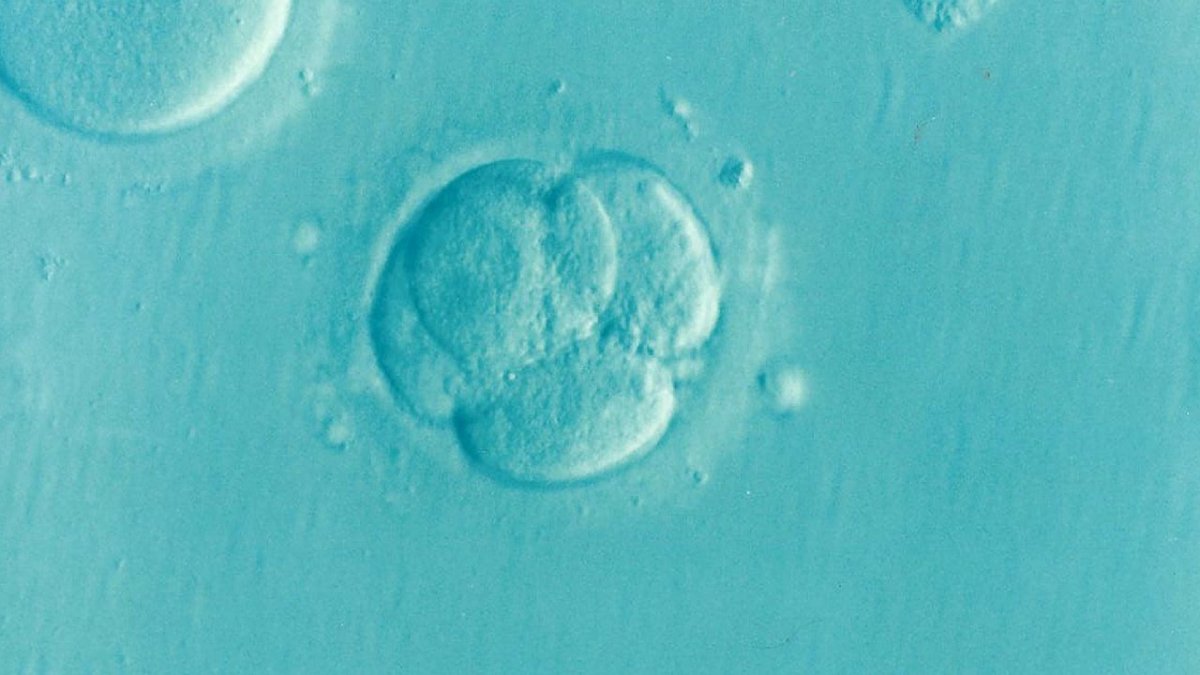 embryo-ivf-microfertilization-stockpack-pixabay.png embryo, ivf, microfertilization