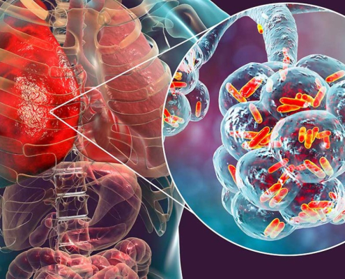 Legionella Main 02