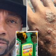 Roundup Cancer Trial