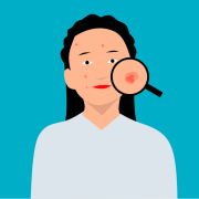 acne-face-girl-stockpack-pixabay.png acne, face, girl
