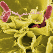 bacteria-salmonella-pathogens-stockpack-pixabay.jpg bacteria, salmonella, pathogens