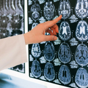 Finger pointing to a brain scan