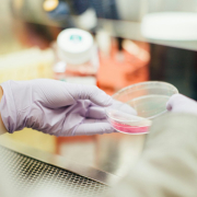 scientist-with-a-petri-dish-stockpack-unsplash.jpg Scientist with a Petri dish