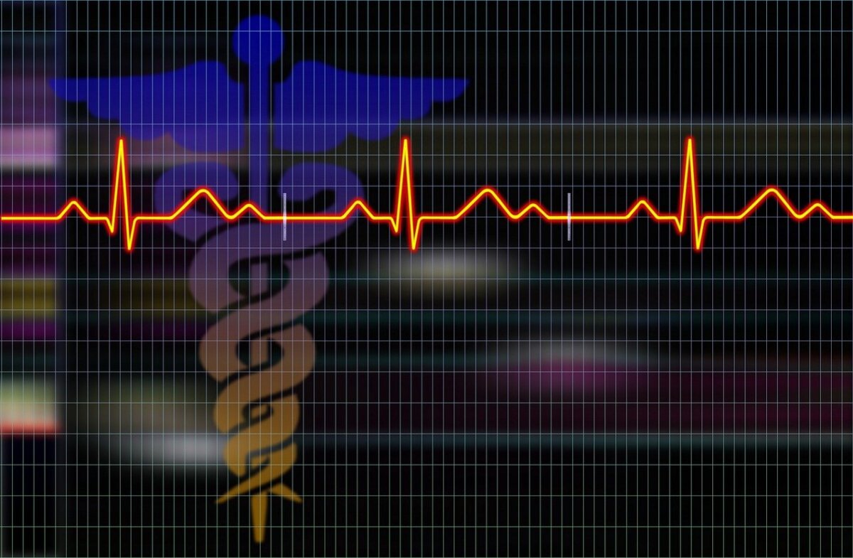 cardiogram-heartbeat-medical-stockpack-pixabay.jpg cardiogram, heartbeat, medical