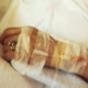 a-closeup-of-a-chemotherapy-iv-in-a-patients-hand-stockpack-unsplash.jpg A closeup of a chemotherapy IV in a patient's hand.