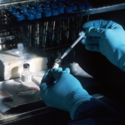 vaccine-hands-of-a-scientist-under-a-sterile-hood-preparing-the-carcinoembryonic-antigen-cea-vaccinia-used-to-try-to-prevent-cancer-the-scientist-is-diluting-the-concentrated-vaccinnia-virus-into-a-do-stockpack-unsplash.jpg Vaccine. Hands of a scientist, under a sterile hood, preparing the carcinoembryonic antigen (CEA) vaccinia used to try to prevent cancer. The scientist is diluting the concentrated vaccinnia virus into a dose level appropriate for administration to a patient. This vaccinnia marks any cancer cells expressing the CEA.