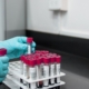lab-experiment-test-chemistry-test-tubes-laboratory-hands-gloves-surgical-gloves-blood-samples-stockpack-pixabay.jpg lab, experiment, test, chemistry, test tubes, laboratory, hands, gloves, surgical gloves, blood samples, lab, lab, lab, lab, lab, chemistry, laboratory, laboratory, laboratory, laboratory