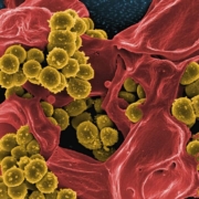 Methicillin-Resistant Staphylococcus aureus (MRSA) Bacteria Colorized scanning electron micrograph of methicillin-resistant Staphylococcus aureus (MRSA) bacteria (gold) interacting with a human neutrophil (red). Image captured at NIAID's Rocky Mountain Laboratories (RML) in Hamilton, Montana. Credit: NIAID https://www.flickr.com/photos/niaid/53362150191/