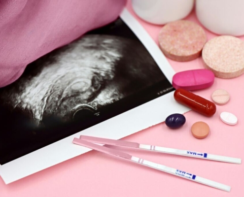pregnancy-test-with-ultrasound-and-supplements-stockpack-pexels.jpg Pregnancy test with ultrasound and supplements