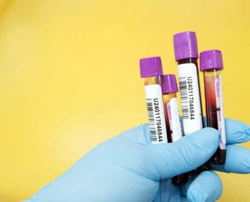 sample-lab-laboratory-scientist-test-medical-healthcare-health-research-science-tube-yellow-health-yellow-medical-yellow-science-yellow-research-yellow-lab-yellow-test-yellow-blood-yellow-laboratory-y-stockpack-pixabay.jpg sample, lab, laboratory, scientist, test, medical, healthcare, health, research, science, tube, yellow health, yellow medical, yellow science, yellow research, yellow lab, yellow test, yellow blood, yellow laboratory, yellow healthcare